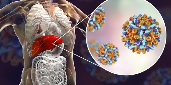 Hepatitis