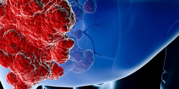 tumores-hepaticos-1-1280x720